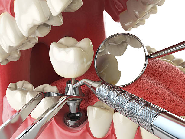 , RI Emergency Dentist Company